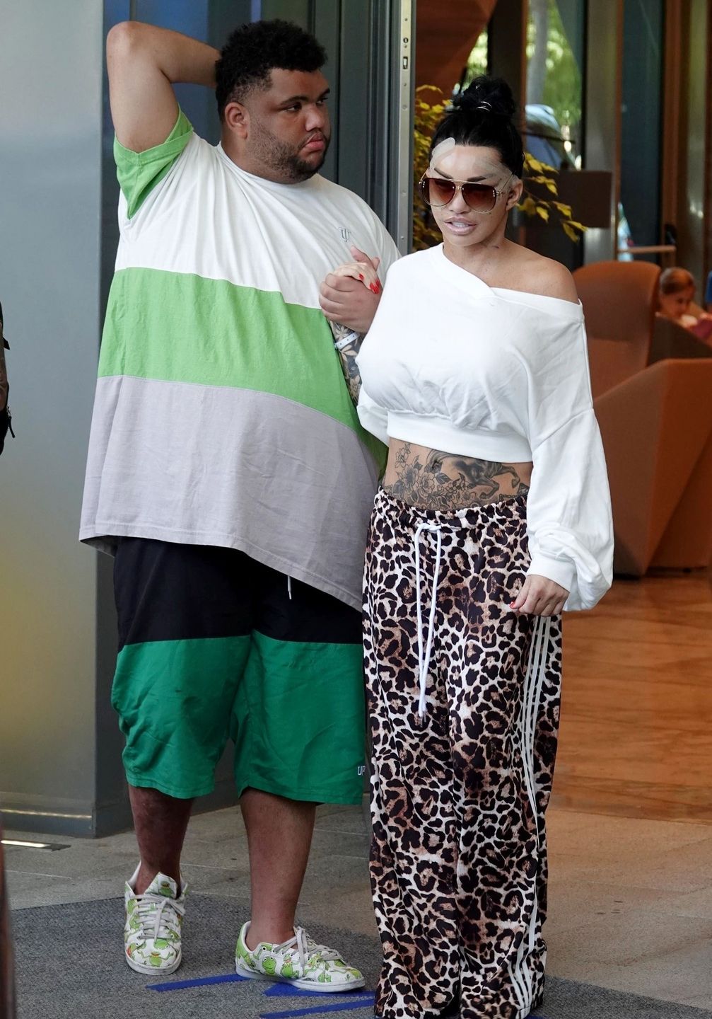 Katie Price sfotografowana tuż po wykonaniu 6. liftingu twarzy 