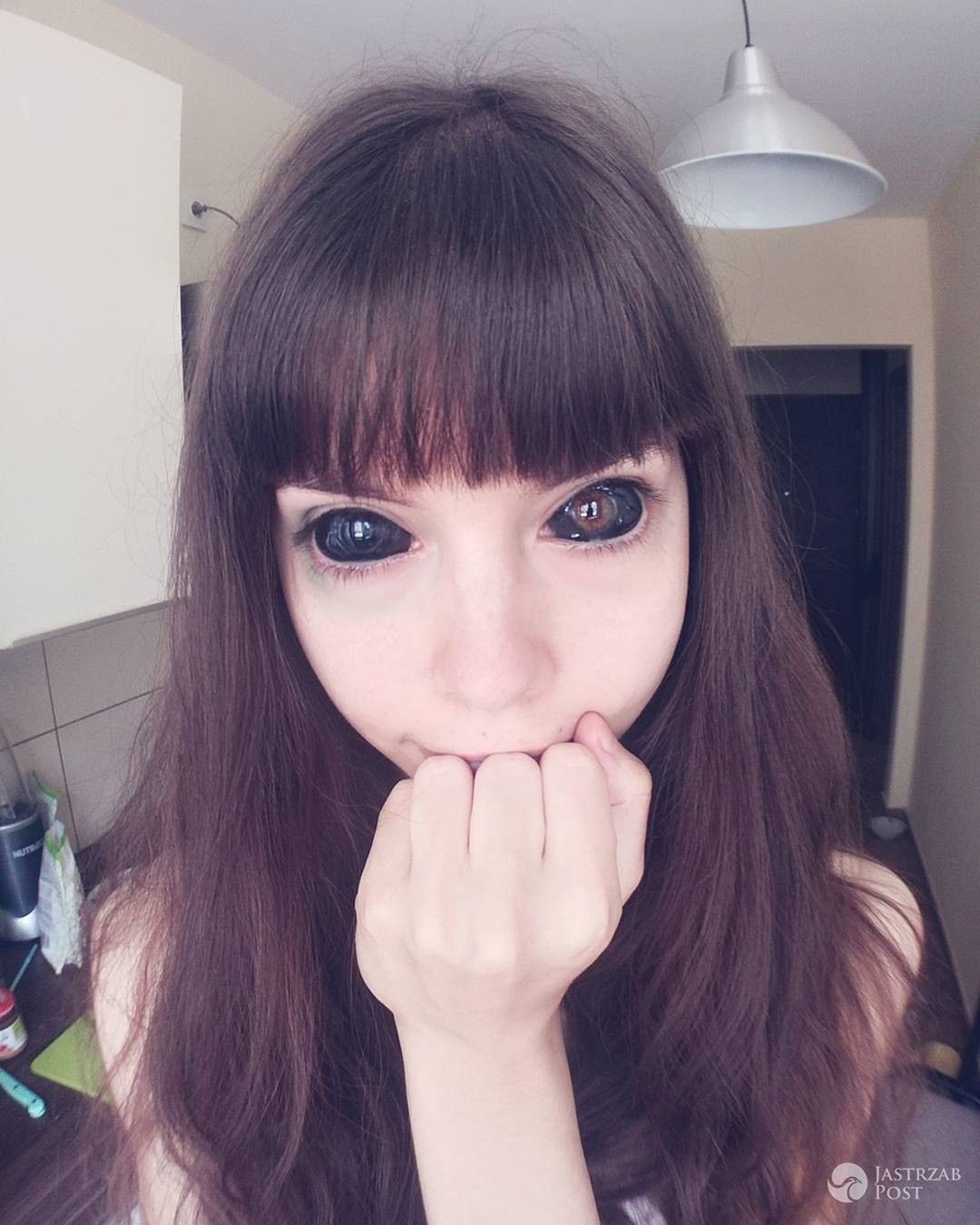 Anoxi Cime, fanka Popka, straciła wzrok