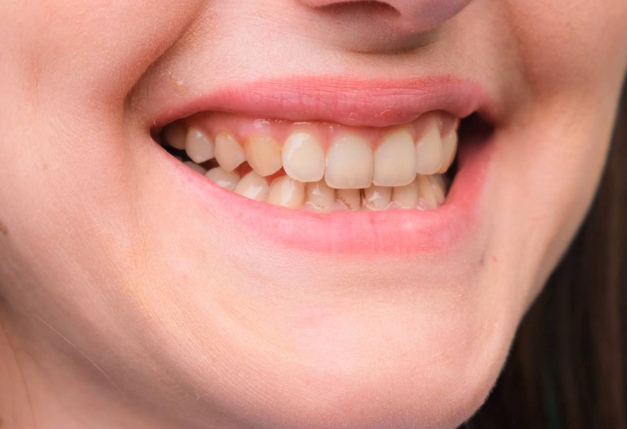 Dentysta zdradził, jak uniknąć żółtych zębów