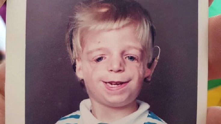 Kiedy się urodził, rodzice porzucili go w szpitalu. "Nie podobała im się moja twarz"