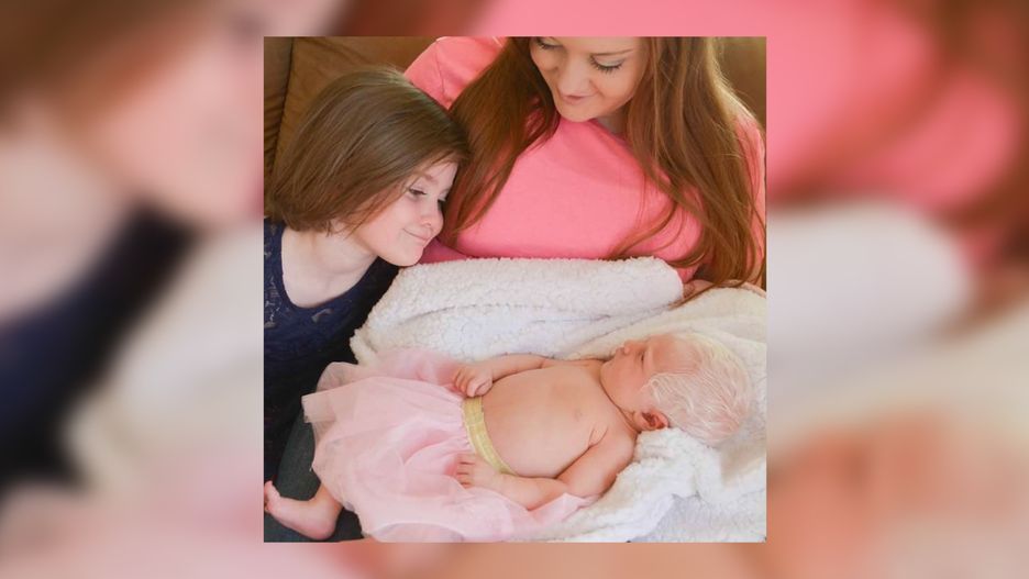 Noralynn urodziła się z białymi włosami