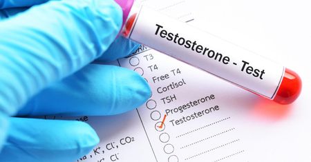 DHT, czyli dihydrotestosteron - charakterystyka, funkcje, niedobór i nadmiar