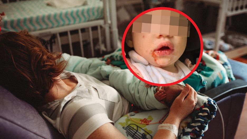 Niewinny buziak może okazać się zabójczy dla najmłodszych. Ratownicza medyczna ostrzega