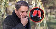 Nowy czynnik groźnej choroby. "Połowa rezerw płuc jest utracona"