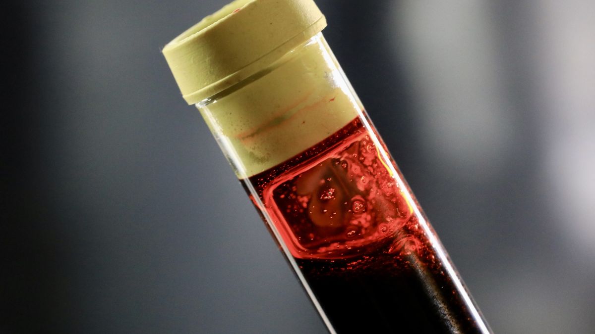 Blood sample in a clinic test tube
Douglas Sacha
patient protection and affordable care act, exam