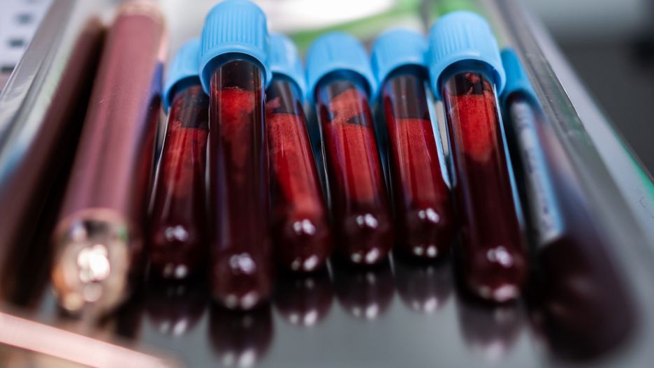 Badanie krwi z ramienia