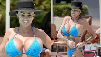 Katie Price wypoczywa po szóstym liftingu twarzy, eksponując sylwetkę w skąpym bikini (ZDJĘCIA)