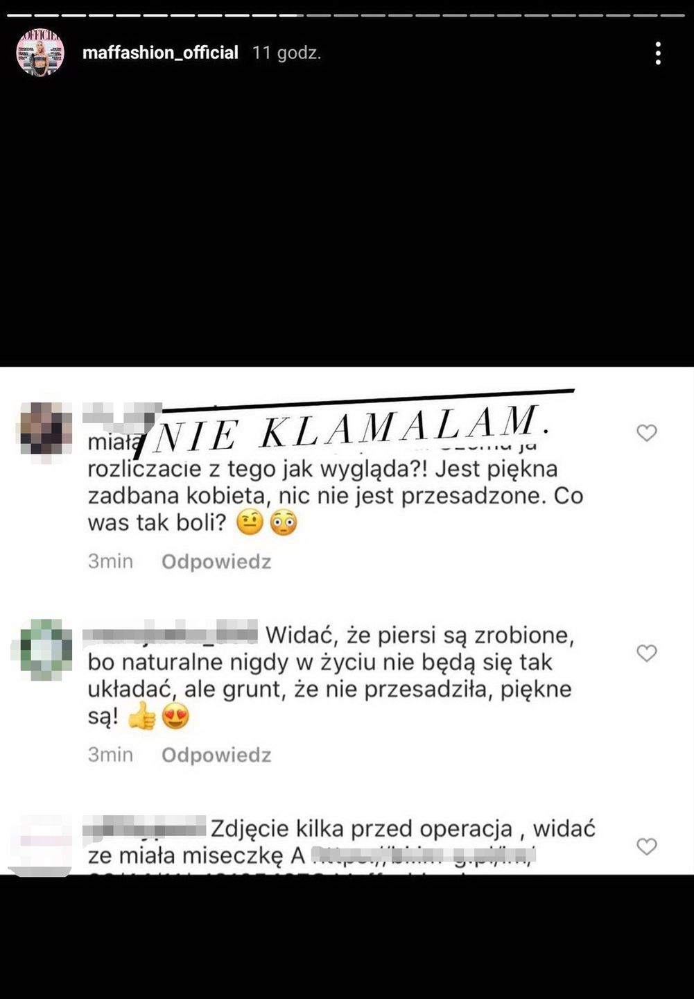 Maffashion odpiera zarzuty o powiększenie biustu i apeluje o empatię