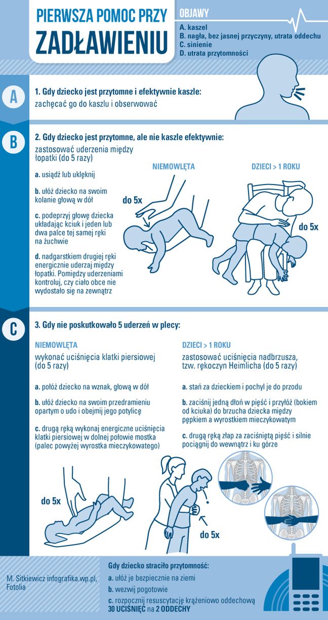 Rękoczyn Heimlicha to pierwsza pomoc przy zadławieniach