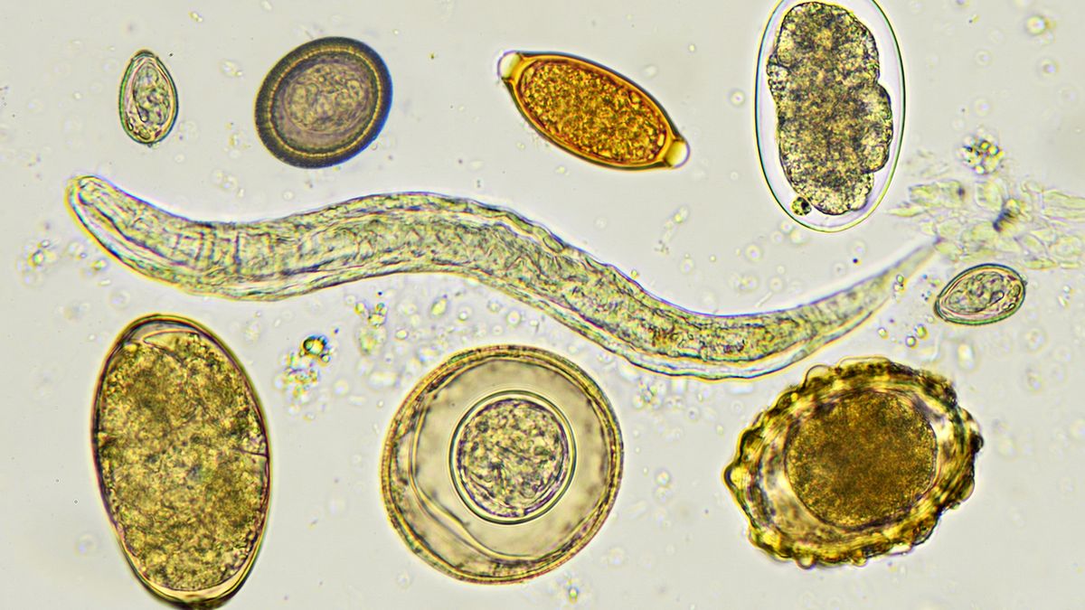 Włosogłówka to pasożyt bytujący w układzie pokarmowym