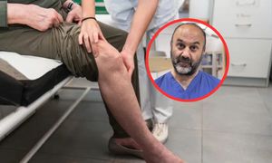 Preludium do miażdżycy. Objaw zapchanych żył widać gołym okiem