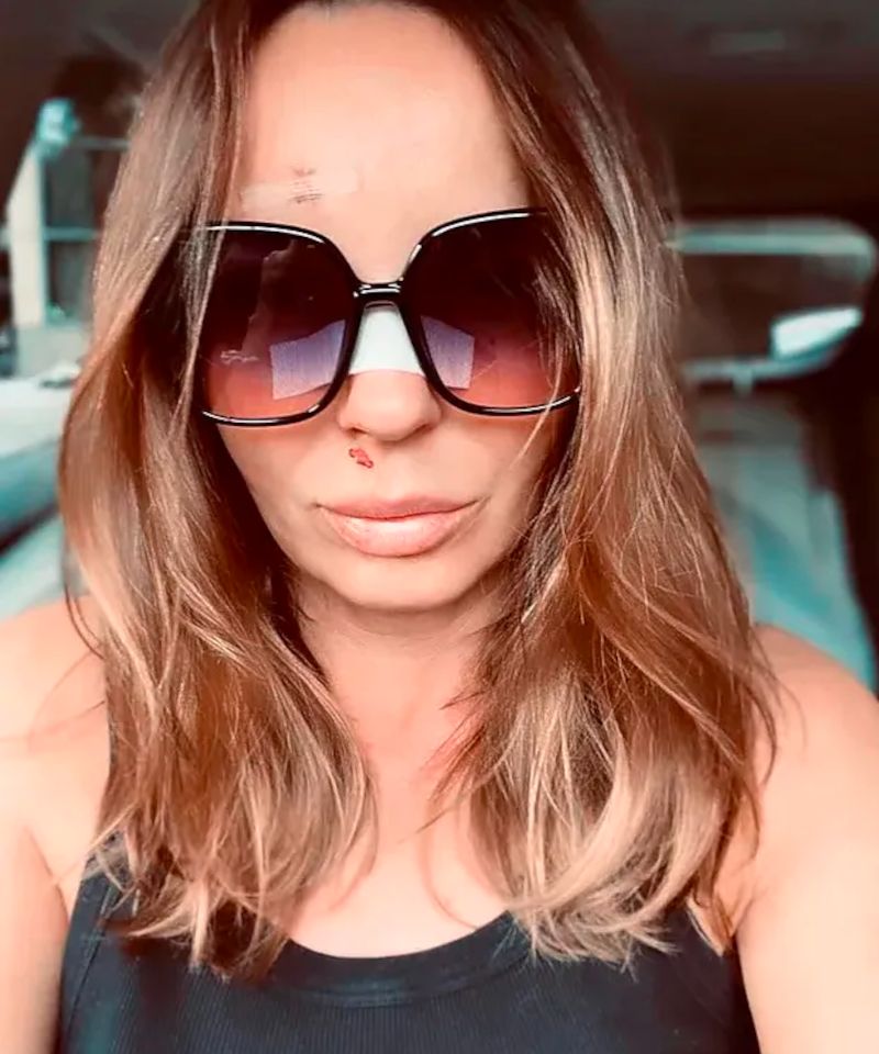 Agnieszka Włodarczyk poleciała na ślub brata do Włoch. Obawiała się, że powstrzyma ją niedawny wypadek 