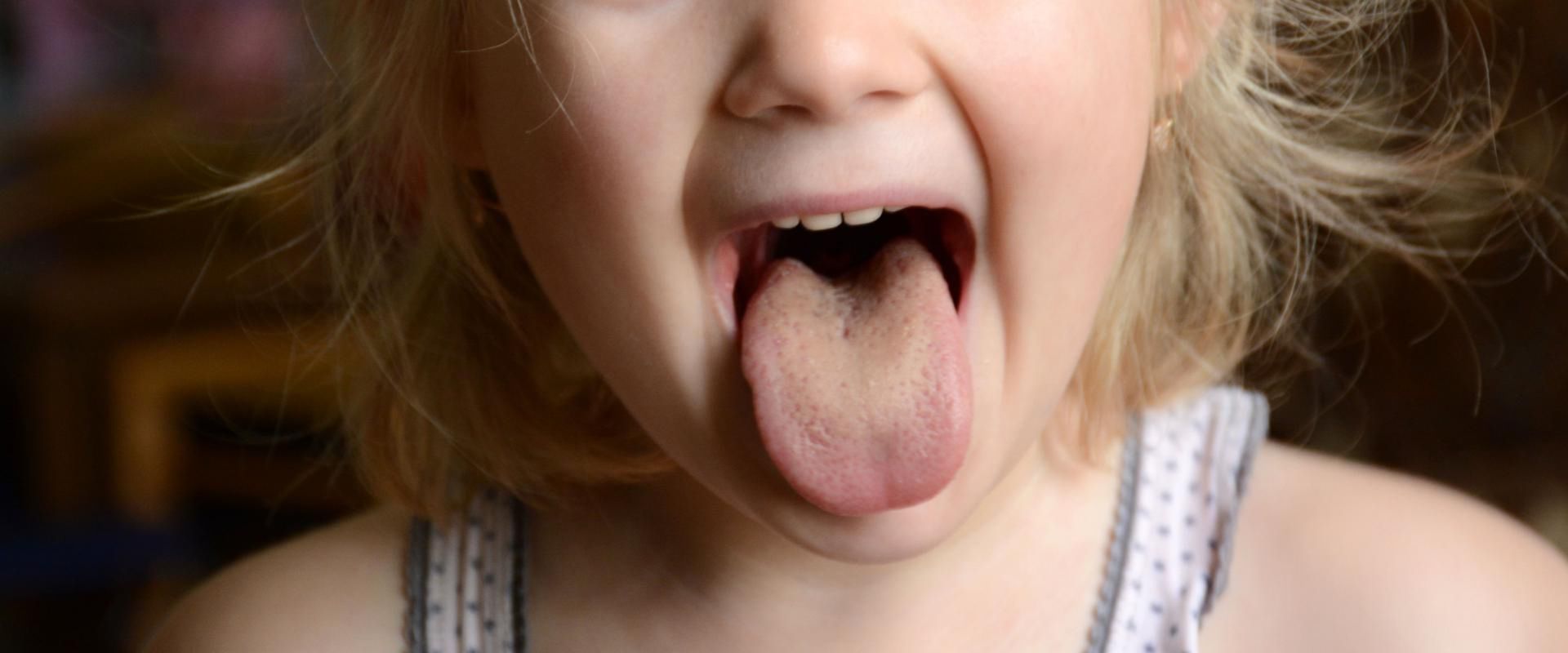 Żółty nalot na języku [123rf.com]