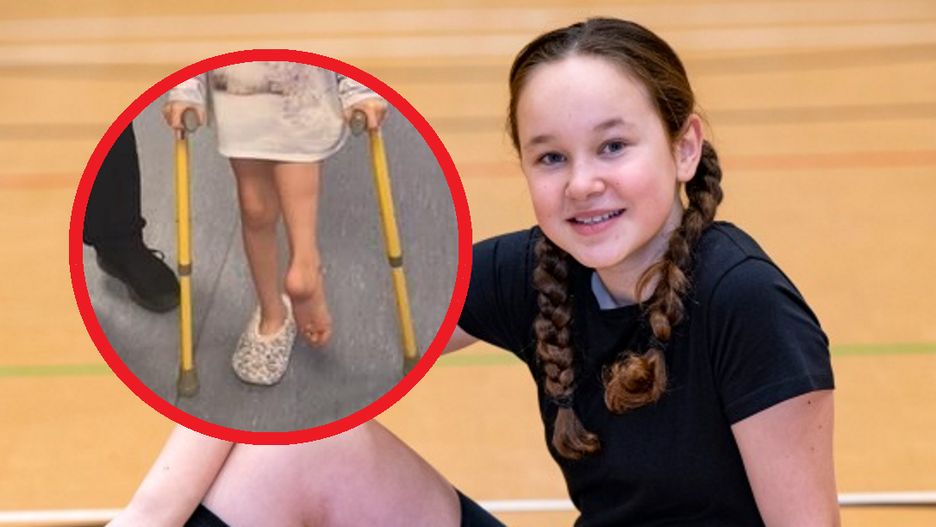 Odważna 12-letnia dziewczyna, której lekarze przyszyli jej nogę do tyłu, po zdiagnozowaniu raka kości zaczyna biegać z nową protezą