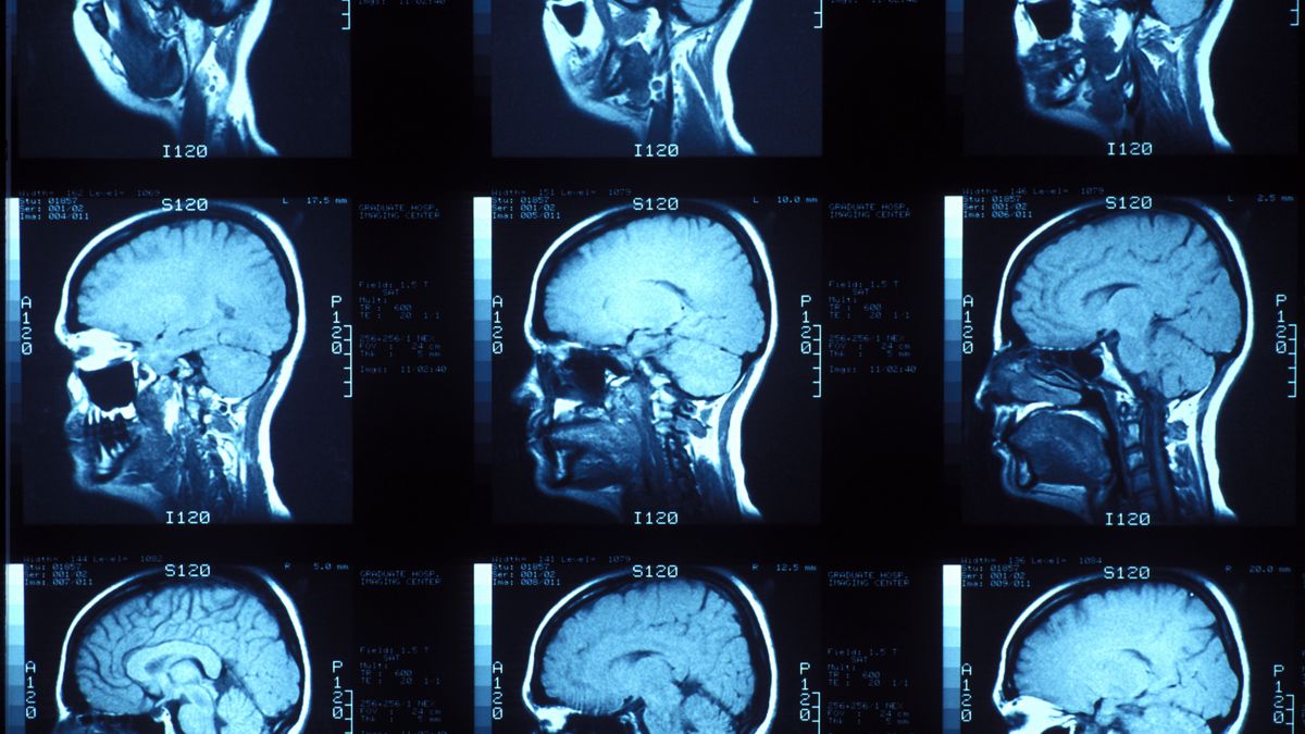 Naukowcy odkryli, co powoduje, że niektórzy ludzie są bardziej skłonni do radykalnych poglądów