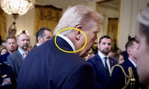 Wysypka na szyi Trumpa. Lekarz prezydenta tłumaczy