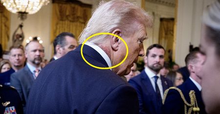 Wysypka na szyi Trumpa. Lekarz prezydenta tłumaczy