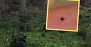 Skuteczny sposób na kleszcze? Sanepid podpowiada