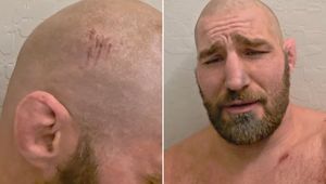 Groźny wypadek gwiazdy MMA. Jechał bez kasku. "Jestem idiotą"