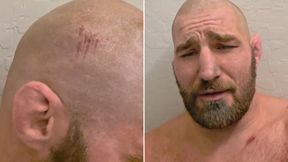Groźny wypadek gwiazdy MMA. Jechał bez kasku. "Jestem idiotą"