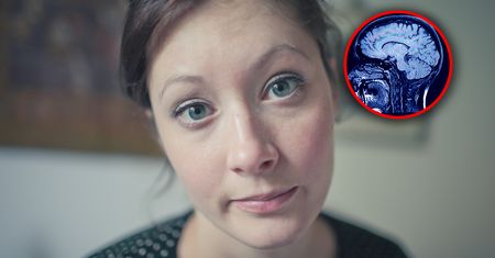 Rocznie z ich powodu umiera 11 mln osób. "Coraz częściej dotykają ludzi młodych"
