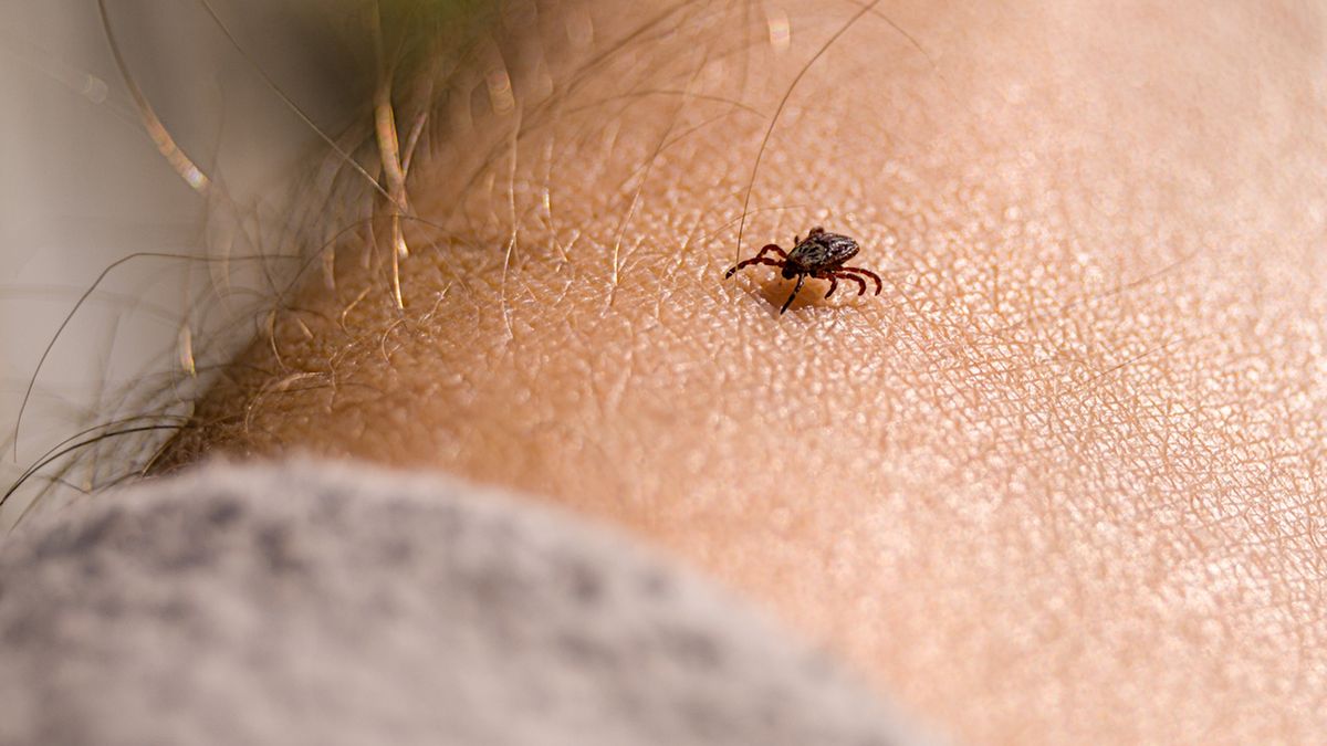 Borelioza to choroba wywołana przez zakażenie, wywołane bakterią Borelia burgdorferi.