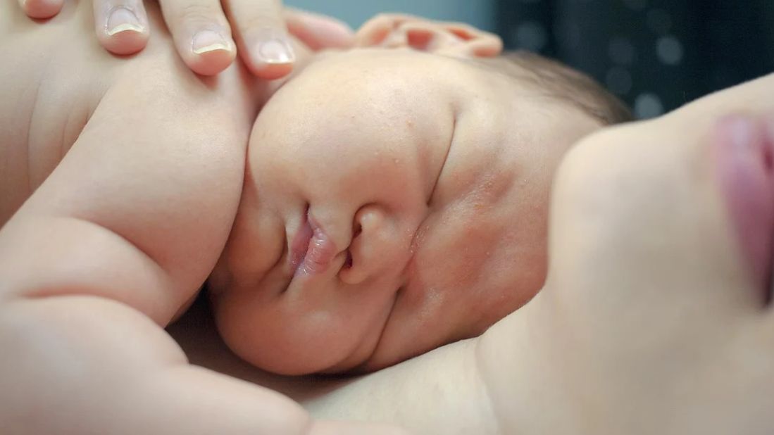 Brachycefalia, czyli krótkogłowie, to termin medyczny odnoszący się do zniekształcenia główki dziecka. 