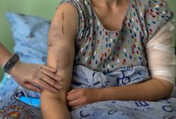 Rosjanie torturują Ukraińców w Chersoniu. "Najgorsze były ślady oparzeń na genitaliach"