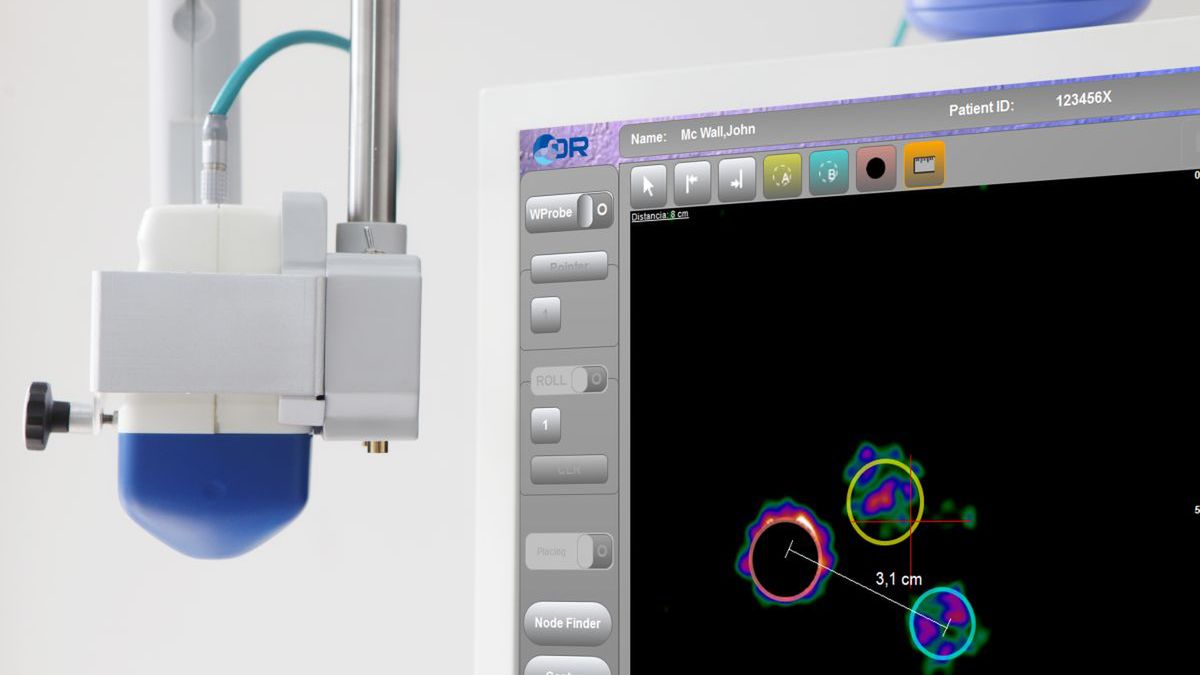 Gamma kamera pozwala z dużą precyzją wskazać komórki rakowe