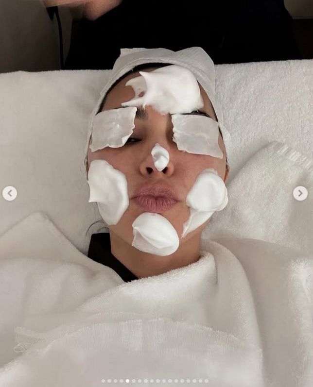 Kim Karadashian podczas zabiegu