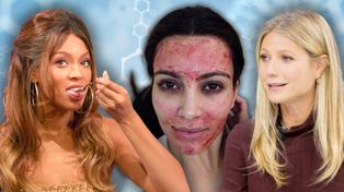 Kim Kardashian wcierała własną krew w twarz, a jej siostra piła nasienie męża. Oto największe absurdy praktykowane przez gwiazdy