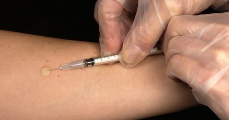 Koronawirus. Szczepionka przeciwko gruźlicy chroni przed zakażeniem COVID-19? Wyniki najnowszych badań