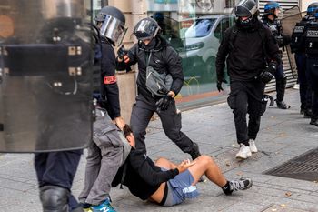 Koszmar we Francji. 15-latek stracił dłoń
