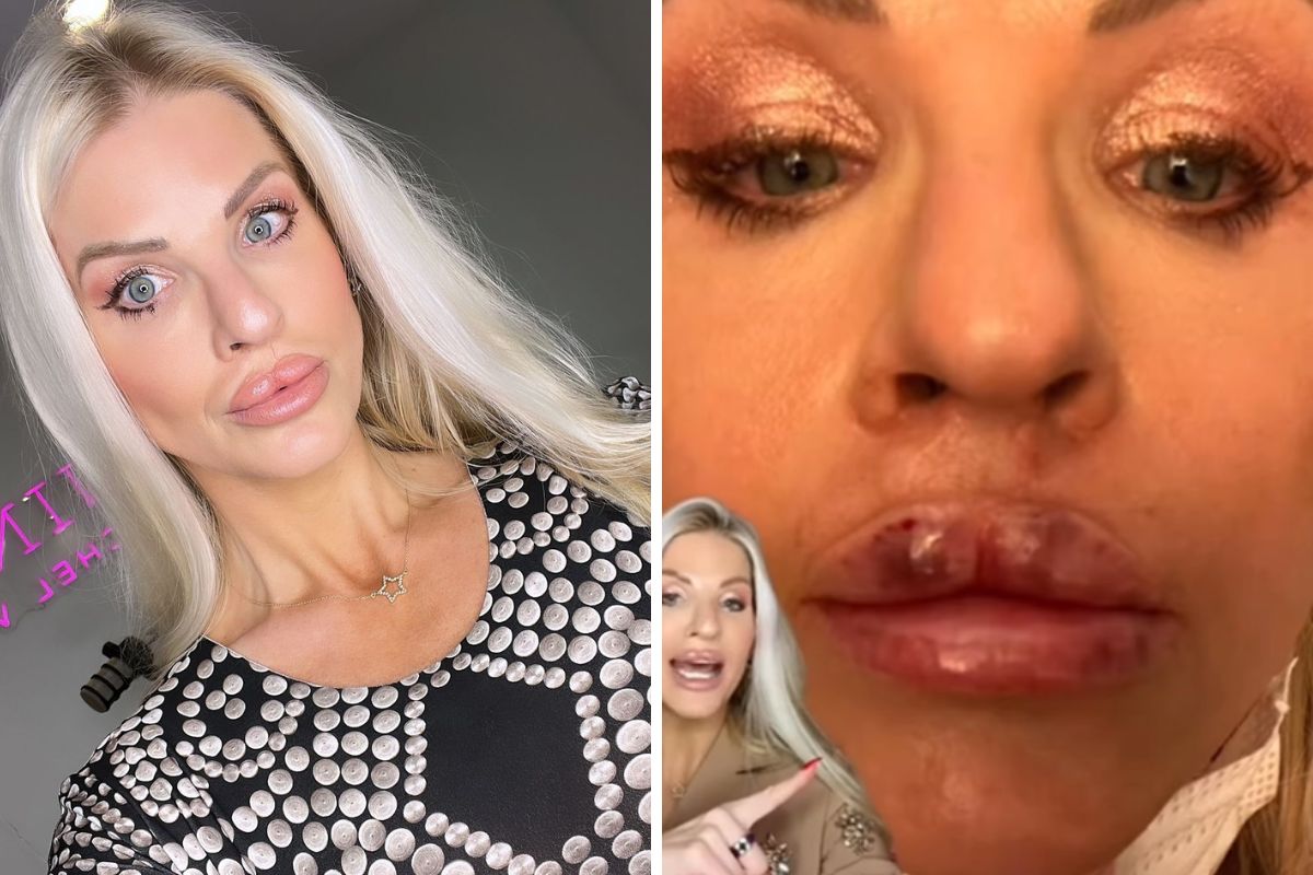 Urodziła się z tzw. zajęczą wargą