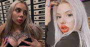 Influencerka chciała zmniejszyć usta. Po zabiegu urosły do MONSTRUALNYCH rozmiarów. "PRAWIE UMARŁAM"