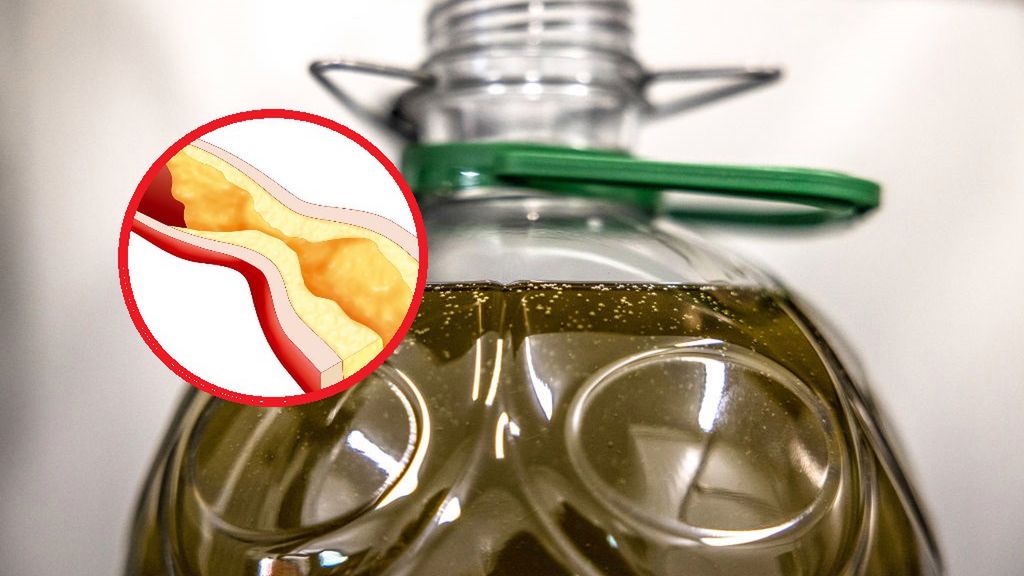 Produkty, które chronią żyły przed zakrzepicą