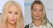 Iggy Azalea poprawiła nos i kształt brody? (ZDJĘCIA)