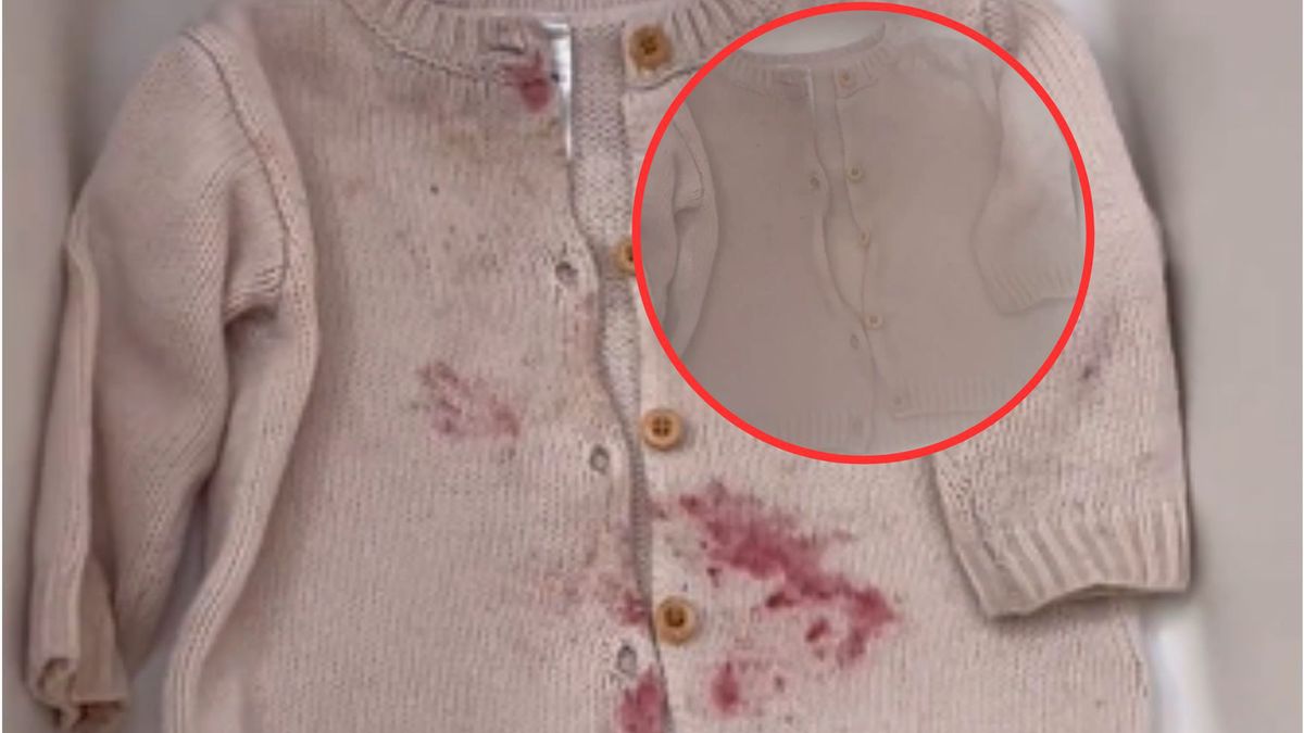 Genialny patent na plamy