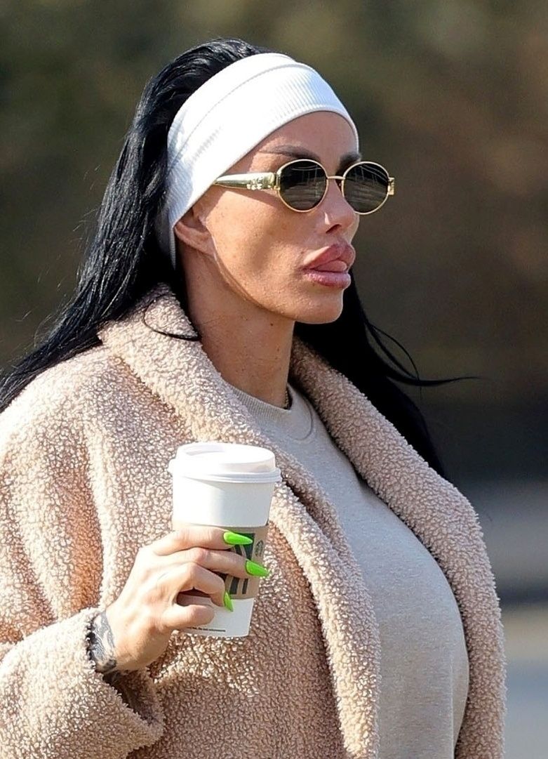 Katie Price prezentuje nowe usta