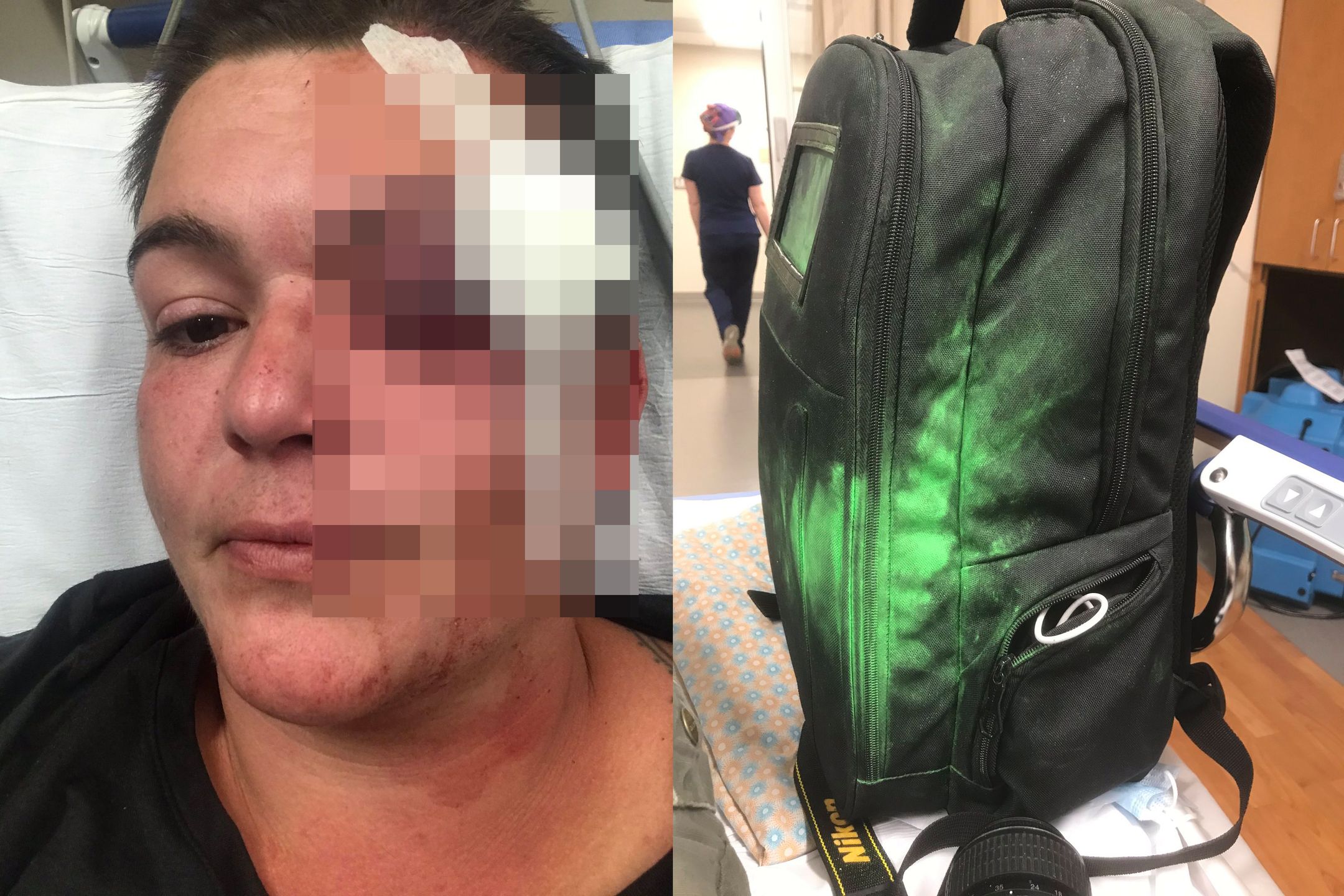 Fotografowie i dziennikarze atakowani przez policję w USA. Są poszkodowani 1