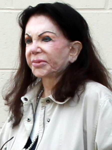 Jackie Stallone: Operacje plastyczne zdeformowały jej twarz