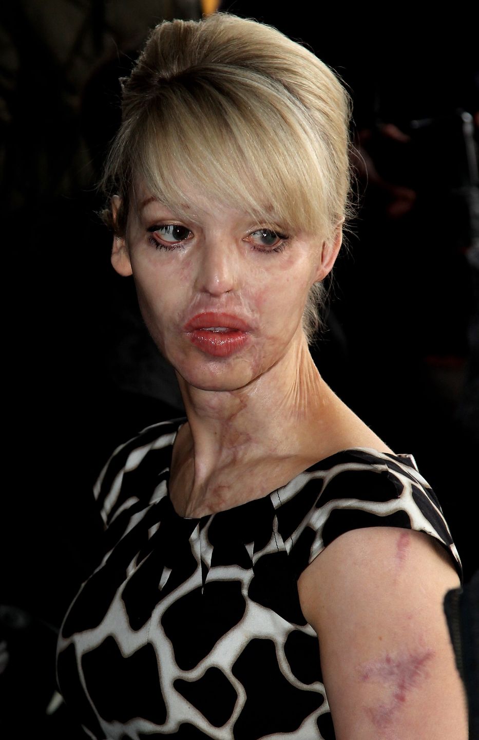 Katie Piper dawniej