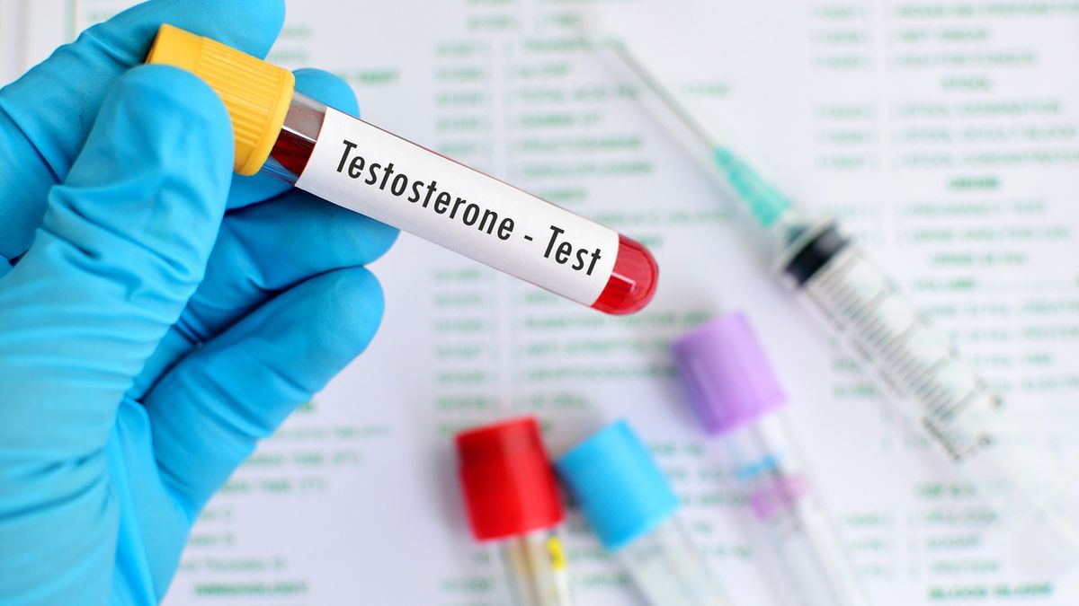 Testosteron wolny – charakterystyka, wskazania, opis badania, niski poziom, wysoki poziom, leczenie
