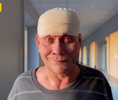 Надскладна операція для українця у Польщі. Пересадили м’яз зі спини на голову