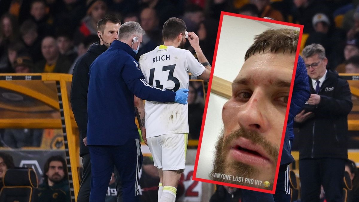 Getty Images / Laurence Griffiths / Twitter/cli5hy / Na zdjęciu: Mateusz Klich (Leeds kontuzjowany w meczu z Wolverhampton