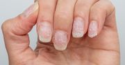 Wcieraj w paznokcie regularnie. Już nie będą cienkie jak papier po hybrydzie