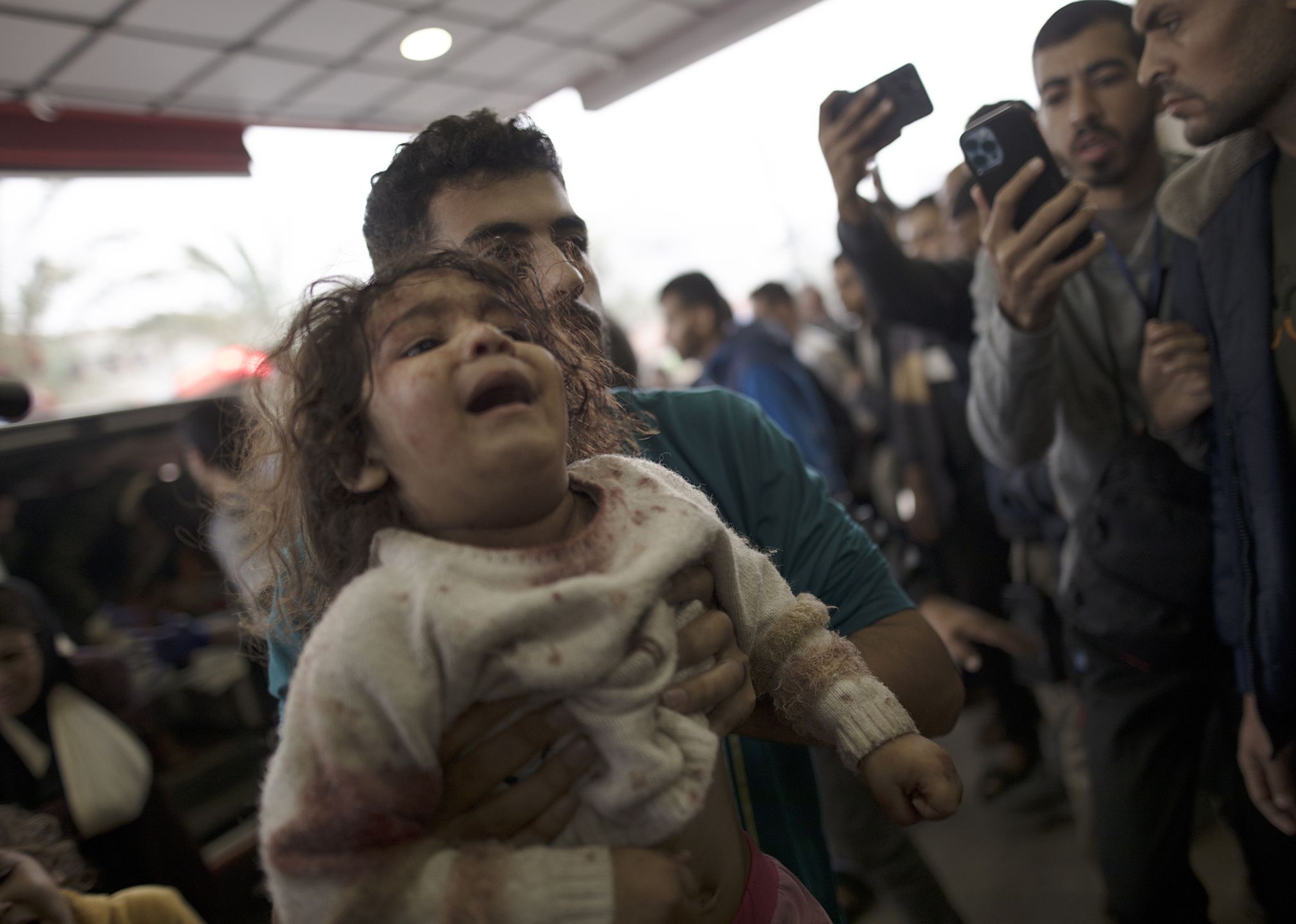 Injured Palestinians at Nasser Hospital following strikes on southern Gaza
epa11011551 A young girl wounded in Israeli air strikes on southern Gaza is carried to Nasser Hospital in Khan Yunis, southern Gaza Strip, 05 December 2023. Israeli forces resumed military strikes on Gaza after a week-long truce ended on 01 December. More than 15,500 Palestinians and at least 1,200 Israelis have been killed, according to the Palestinian Ministry of Health and the Israel Defense Forces (IDF), since Hamas militants launched an attack against Israel from the Gaza Strip on 07 October, and the Israeli operations in Gaza and the West Bank which followed it.  EPA/HAITHAM IMAD 
Dostawca: PAP/EPA.
HAITHAM IMAD