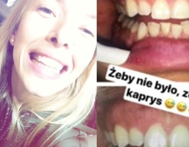 Ewa Chodakowska pochwaliła się na Instagramie... wizytą u dentysty