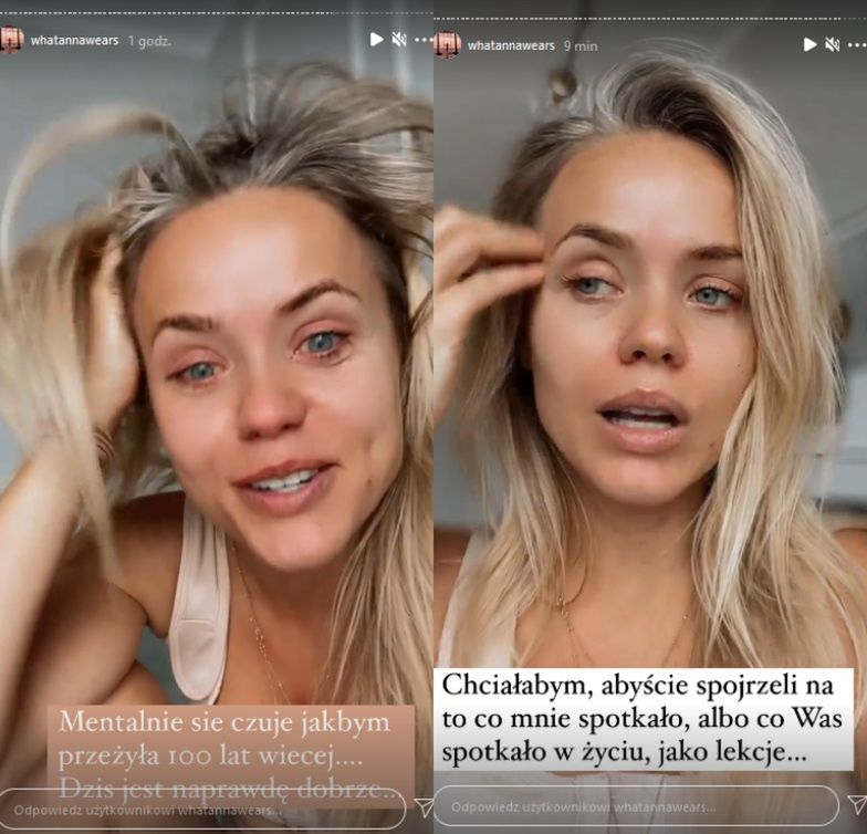 Anna Skura kontynuuje temat nieudanego zabiegu powiększania piersi