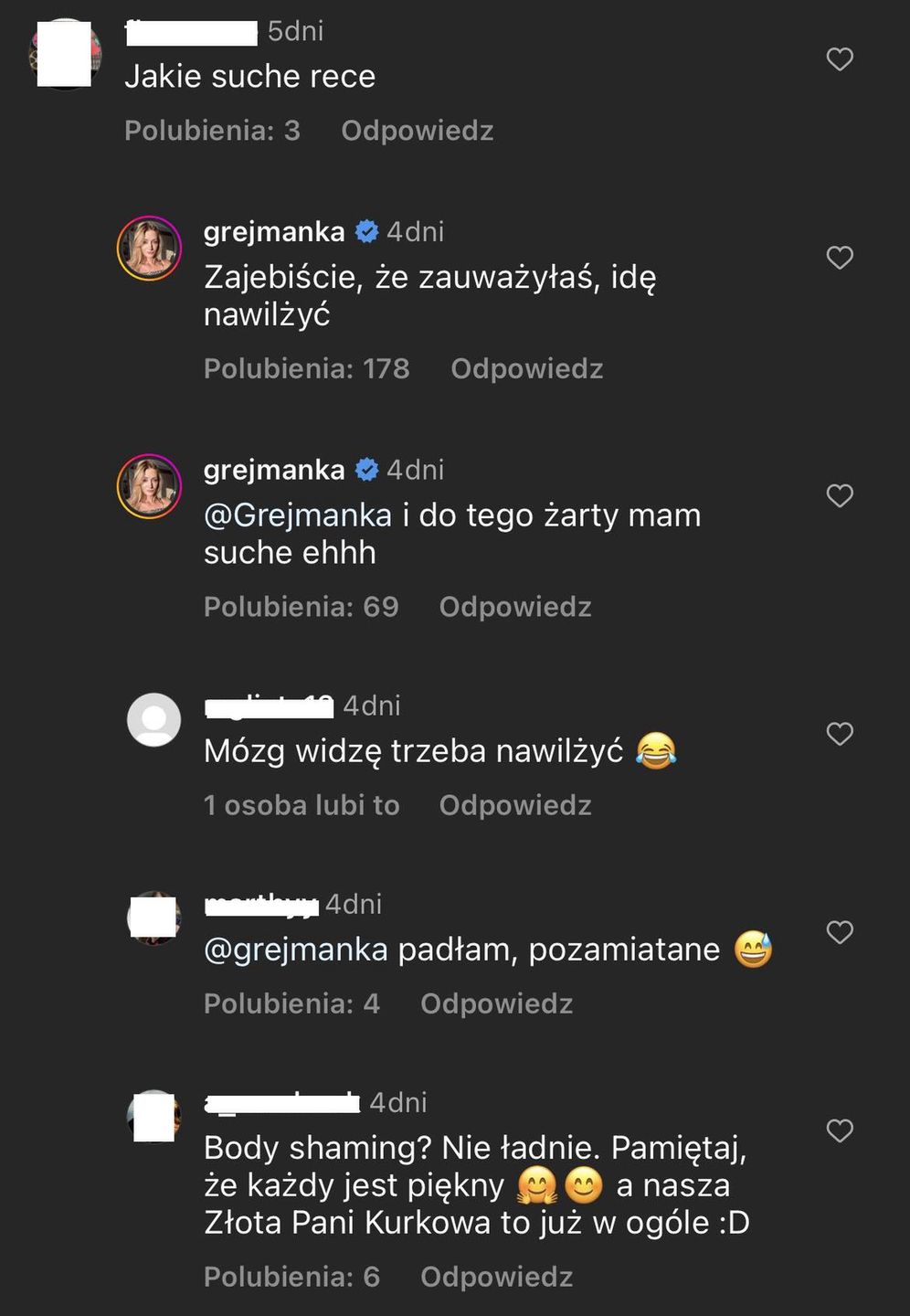 Anna Kurek reaguje na komentarz o "suchych rękach"